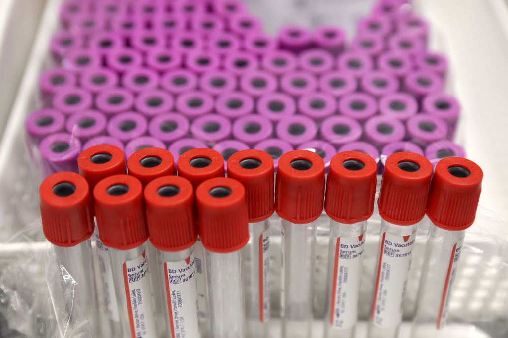 Empty blood vials sit on a table at Vitalant blood donation center